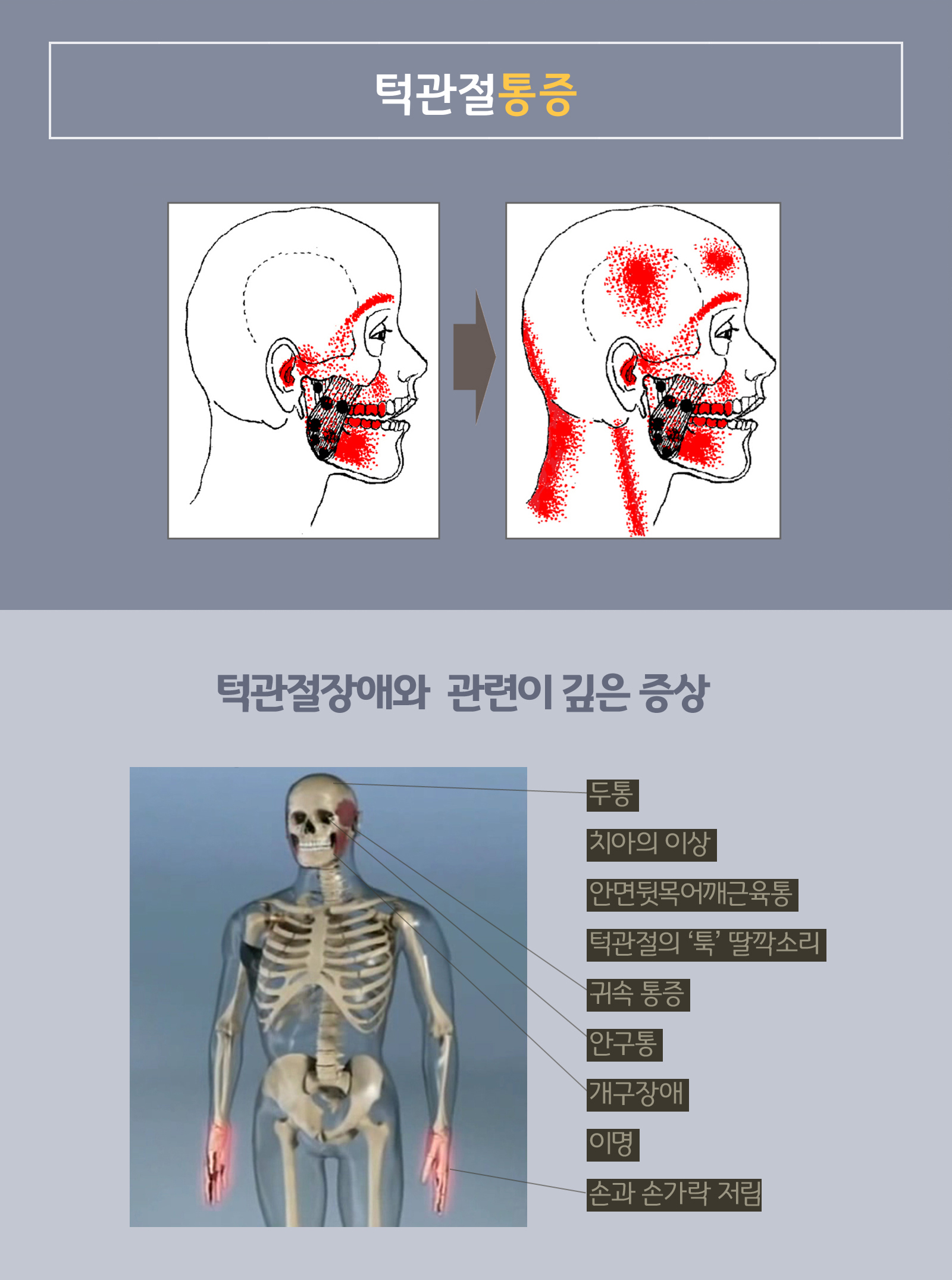 ΰ 